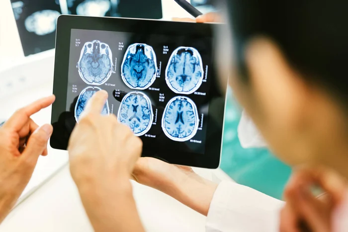 Implant-cerebral-testat-pentru-a-redobndi-controlul-asupra-braelor-paralizate
