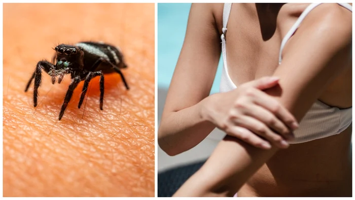 Invazia-plonielor-de-pat-creeaz-isterie-n-Frana-i-strnete-o-disput-politic-la-Paris-n-timp-ce-flagelul-insectelor-continu