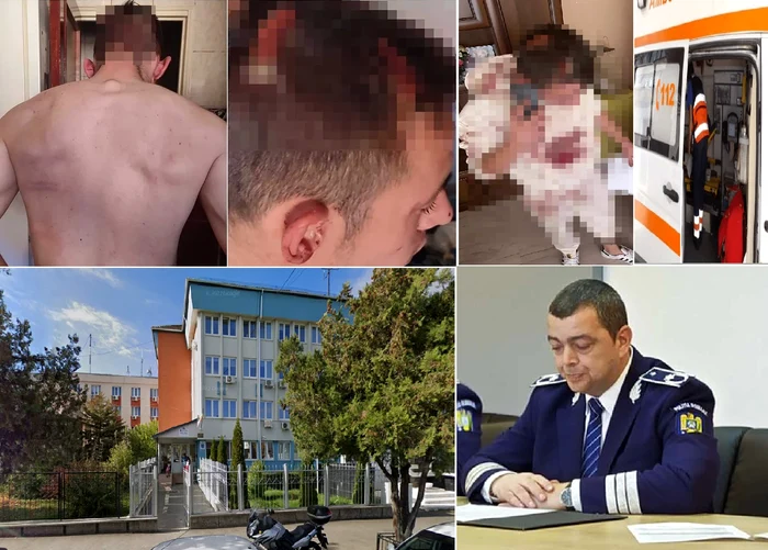 Ultraj-i-abuz-n-serviciu-la-Sibiu-Un-tnr-care-s-a-opus-unei-legitimri-s-a-ales-cu-capul-spart