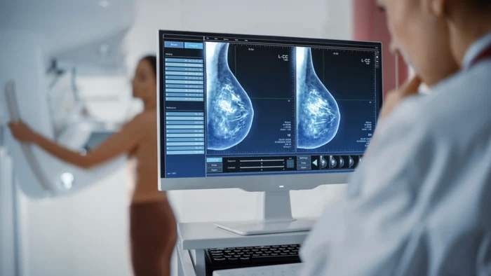 Cancerul-de-sn-boal-letal-ce-macin-ncet-Mamografiile-o-investigaie-ignorat