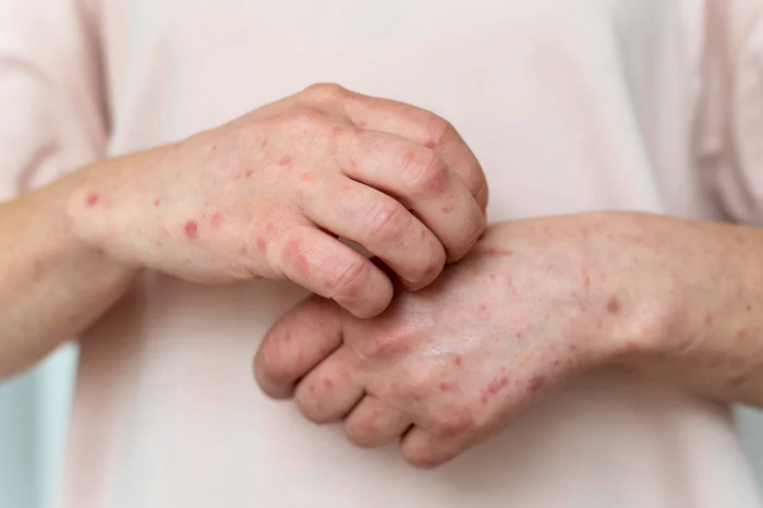 Caz-de-rie-la-un-elev-de-liceu-din-Arad-Din-cauza-ruinii-se-solicit-alt-diagnostic-