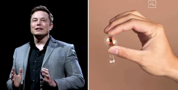 De-ce-ar-trebui-s-fim-sceptici-fa-de-afirmaiile-lui-Elon-Musk-despre-primul-implant-Neuralink
