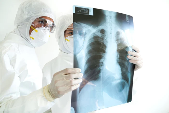 Radonul-ucigaul-invizibil-din-Ardeal-Medic-Se-ataeaz-de-aerosol-i-rmne-la-nivelul-de-1-15-m-nlime-exact-unde-respir-copiii
