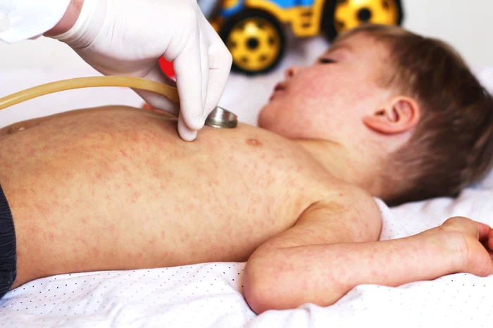Dr-Mihai-Craiu-medic-pediatru-Copiii-romni-primesc-vaccinuri-mai-rar-dect-n-UE-dar-antibiotice-din-plin