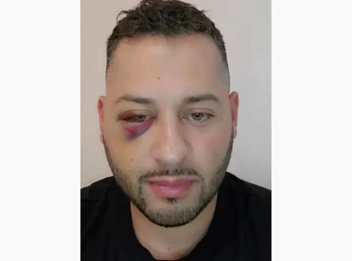 Fostul-preot-Daniel-Bala-btut-crunt-n-trafic-dup-o-icanare-Mi-au-provocat-trei-fracturi-la-maxilar-sinusuri-i-la-osul-de-sub-ochi