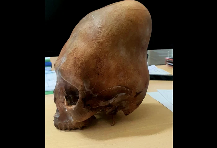 Prinesa-cu-capul-alungit-dovad-a-deformrii-craniilor-n-zona-Buzului-Metoda-folosit-pe-copii