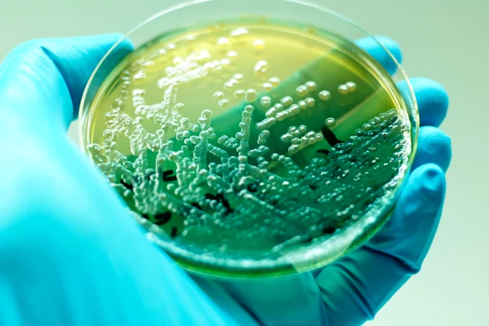---------Bacterie-periculoas-depistat-n-apa-recoltat-de-la-Spitalul-de-Pneumoftiziologie-Floreti