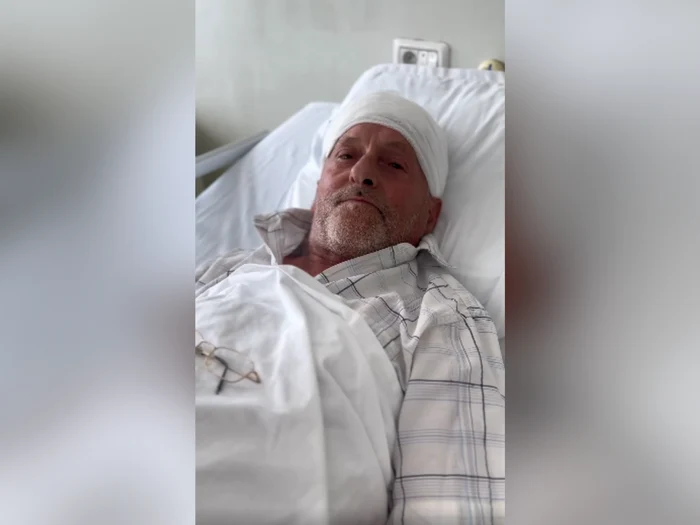 Video----------Brbat-de-67-de-ani-salvat-de-medicii-din-Iai-Acesta-s-a-prezentat-cu-o-tumor-cerebral-uria-de-aproximativ-10-cm