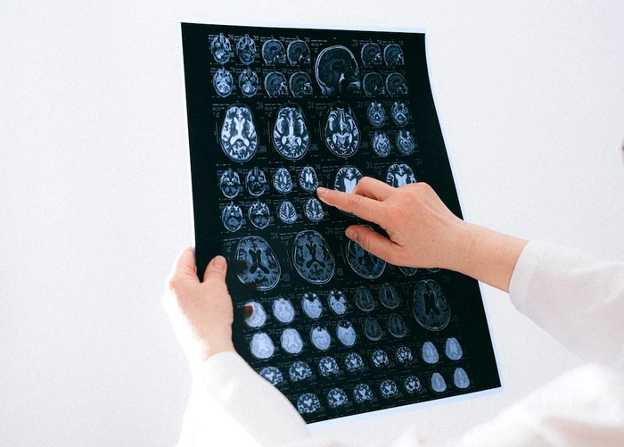 ---------Cele-4-vrste-la-care-creierul-nostru-se-schimb-Adolescena-neuronal-dureaz-pn-la-32-de-ani