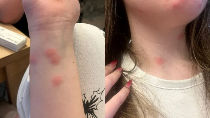 ---------Cltorie-de-comar-n-trenul-CFR-o-tnr-a-ajuns-la-spital-dup-ce-a-fost-mucat-de-plonie