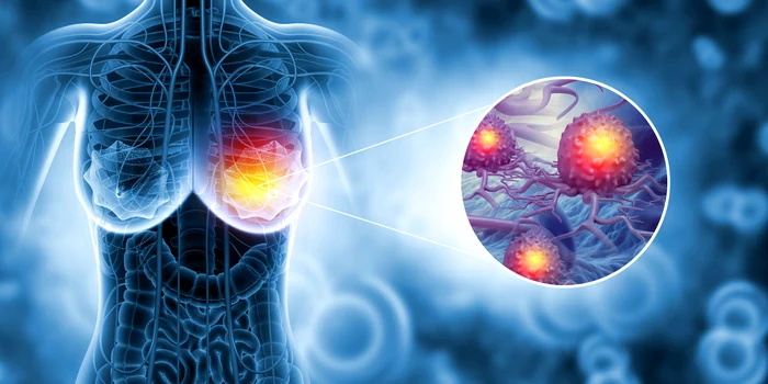 ---------Medic-senolog-despre-ct-de-mult-conteaz-prevenia-i-genetica-n-cancerul-la-sn-Mamografia-dou-minute-care-pot-salva-o-via