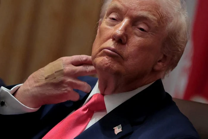 ---------Donald-Trump-a-aprut-din-nou-cu-un-pansament-la-mna-dreapt-Casa-Alb-are-o-explicaie-De-la-aspirin