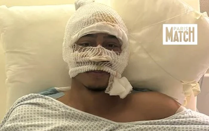 ---------Clipele-tulburtoare-povestite-de-fotbalistul-care-a-scpat-din-infernul-Crans-Montana-Era-ca-n-scenele-de-rzboi-Am-crezut-c-voi-muri