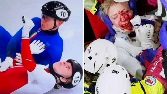 ---------Momente-de-teroare-la-patinaj-vitez-o-sportiv-a-fost-tiat-pe-fa-de-lama-de-la-patina-unei-adversare