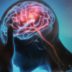 ---------Recuperarea-dup-un-AVC-poate-fi-accelerat-printr-o-metod-mult-mai-eficient-Ce-au-descoperit-oamenii-de-tiin