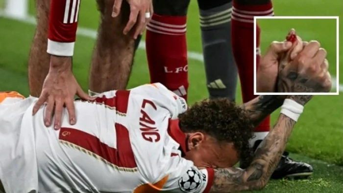 ---------Accidentare-oribil-suferit-de-olandezul-Noah-Lang-la-meciul-Liverpool---Galatasaray-i-lipsete-o-bucat-din-vrful-degetului-mare