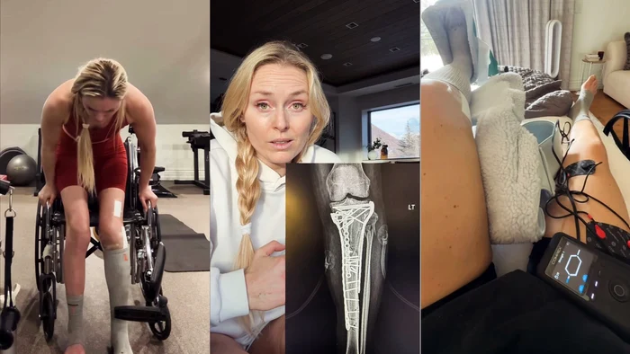 ---------Am-fost-numrul-1-n-lume-acum-sunt-ntr-un-scaun-cu-rotile-Comar-pentru-Lindsey-Vonn-dup-ce-piciorul-i-a-fost-zdrobit-la-JO-Campioana-nu-i-revine