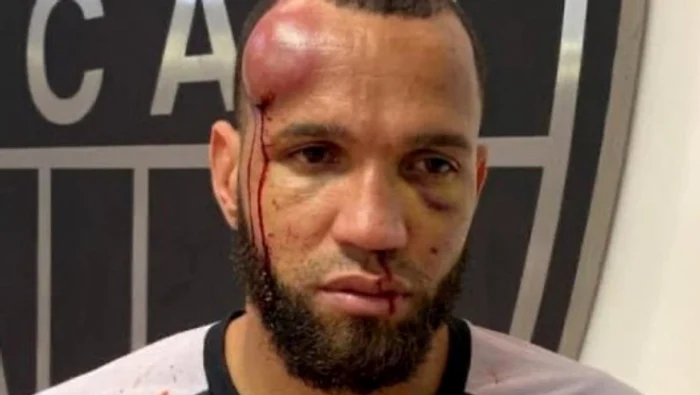 ---------Btaia-secolului-n-Brazilia-fotbalitii-s-au-lovit-cu-pumnii-i-picioarele-Meciul-Cruzeiro-Atltico-Mineiro-a-avut-23-de-eliminai