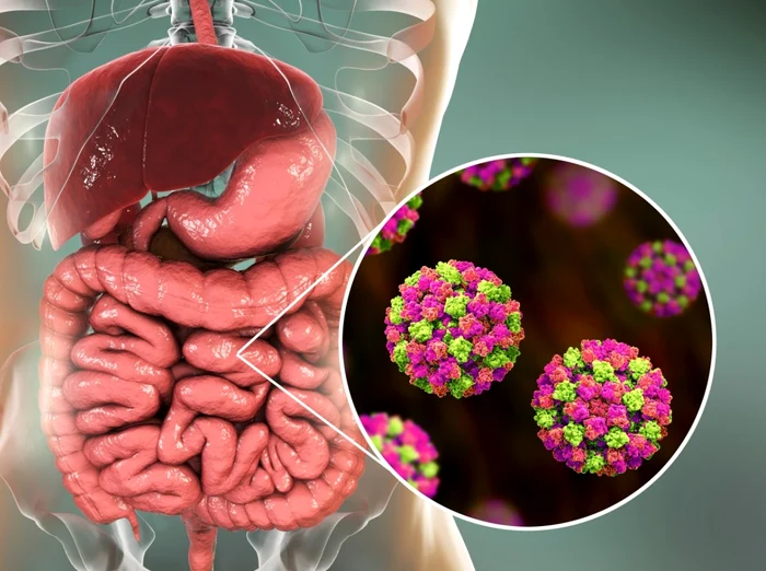 ---------Cre-nchis-dup-mbolnvirea-a-aproape-20-de-copii-Suspiciune-de-norovirus-Anchet-epidemiologic-n-desfurare