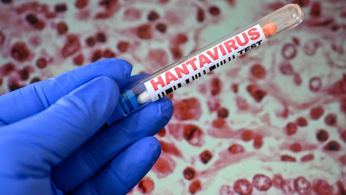 ---------Institutul-Cantacuzino-confirm-cazul-de-hantavirus-din-Arad-Tnrul-de-25-de-ani-este-infectat-cu-tulpina-transmis-de-roztoare