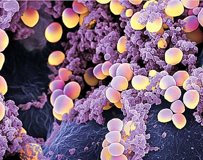---------Salmonella-i-stafilococul-auriu-confirmate-n-cazul-a-zeci-de-persoane-internate-dup-o-nunt-din-Iai