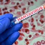 Tânărul din Arad confirmat cu hantavirus, externat după recuperare completă
