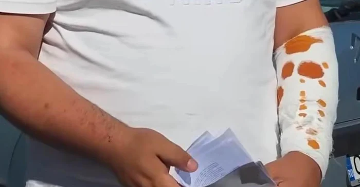 Bărbat din Drăgănești-Olt, stropit cu un lichid corrosiv și amenințat cu cuțitul la o benzinărie din Slatina