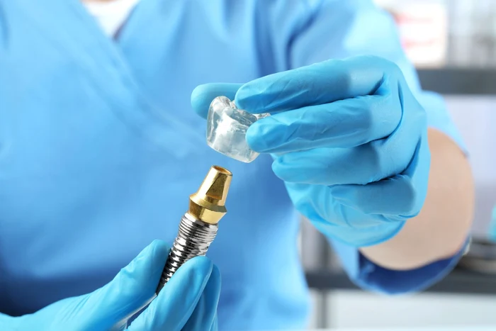 Ce include prețul unui implant dentar complet: etape, componente și costuri ascunse