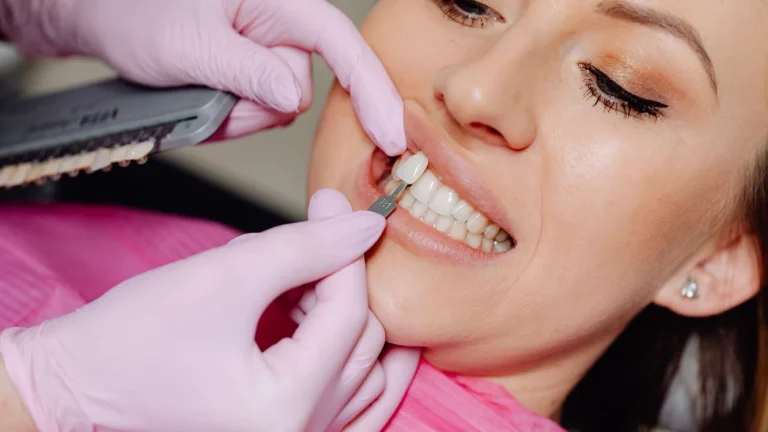 Fațetele dentare: cine poate beneficia și când sunt nepotrivite