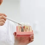 5 mituri despre implantul dentar pe care merită să le verifici
