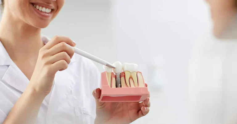 5 mituri despre implantul dentar pe care merită să le verifici