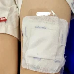 Copil de 6 ani din Botoșani în stare gravă după ce sora i-a pus plasturi cu fentanyl