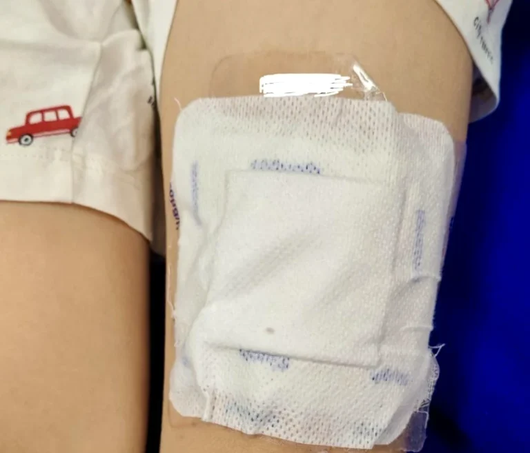 Copil de 6 ani din Botoșani în stare gravă după ce sora i-a pus plasturi cu fentanyl