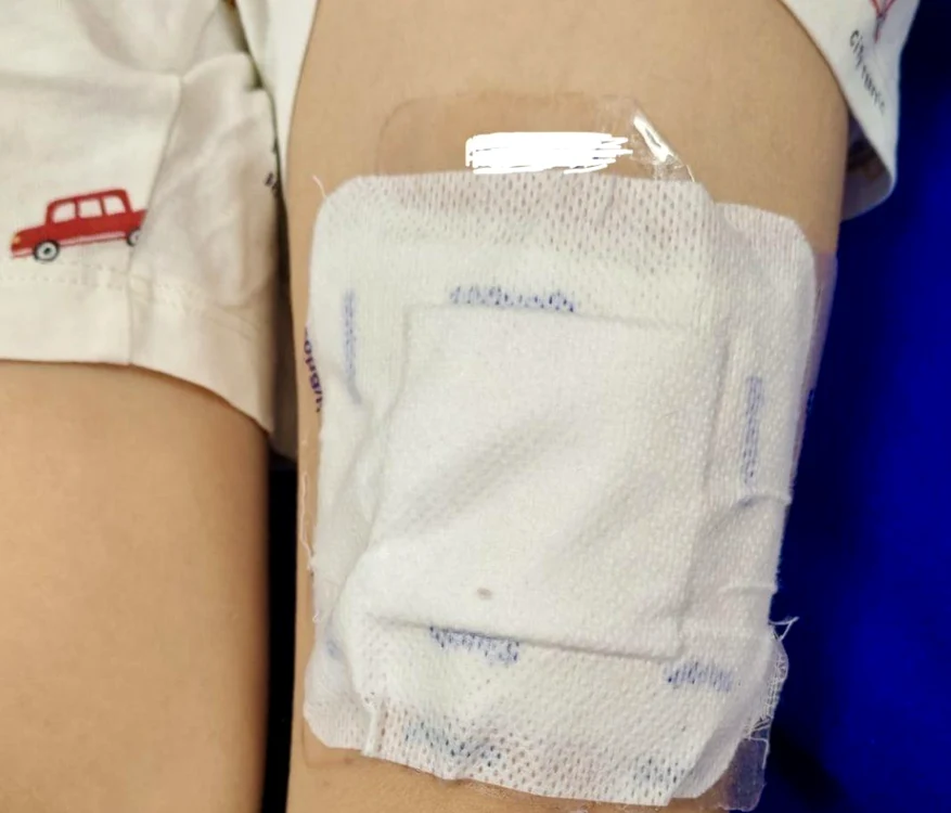 Copil de 6 ani din Botoșani în stare gravă după ce sora i-a pus plasturi cu fentanyl
