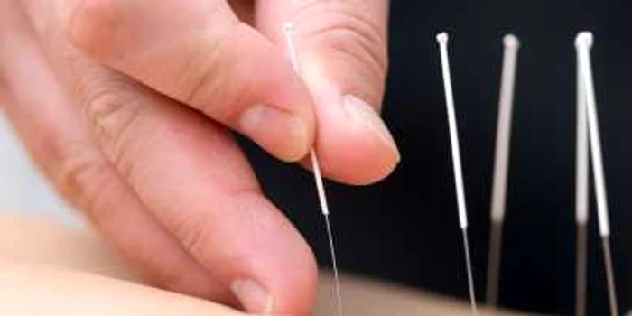 O femeie din Siberia a ajuns la spital după acupunctură: peste zece fragmente de ace, înfipte în picior