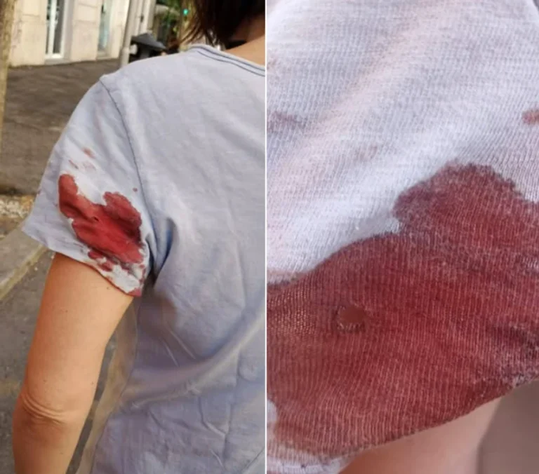 Jurnalistă rănită de un proiectil pe o stradă din Roma; anchetă a carabinierilor pentru identificarea atacatorului