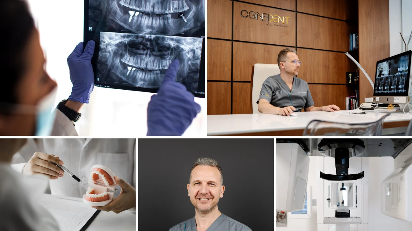 Cât durează un implant dentar: etape, timpi și ce influențează tratamentul