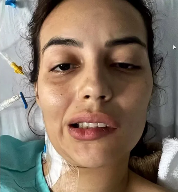 Influenceriţa Yuli Vargas, paralizată pe partea dreaptă după ce a mâncat sushi: 23 de zile de spital şi diagnostice grave