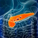 Tratament experimental oral a redus tumorile la 9 din 22 pacienți cu cancer pancreatic metastatic